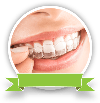 teeth with clear aligners