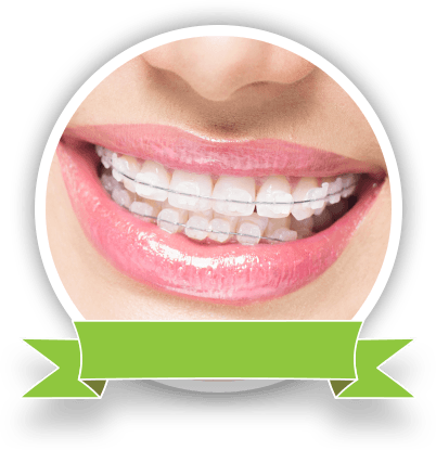 teeth with ceramic braces